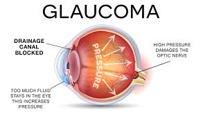 Photo of Enna: giornata di prevenzione del glaucoma con screening e informazione